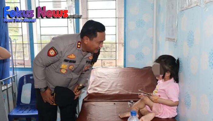 Kapolres Nias Selatan Sambangi Bocah Viral Diduga Korban Kekerasan, Beri Perhatian Khusus